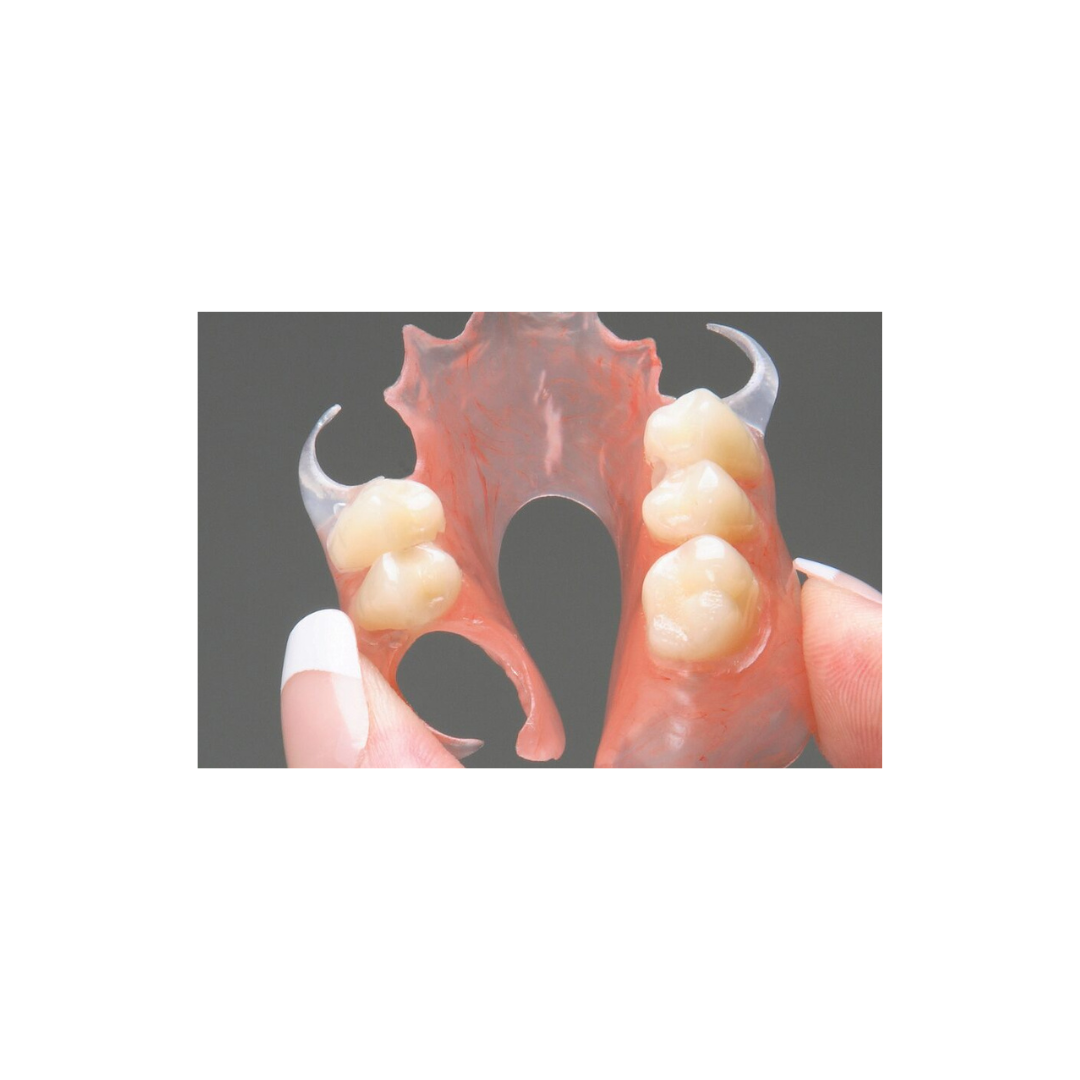 Flexite partial denture
